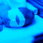 Verloskundigen Dronten - Geelzucht bij baby (Icterus)