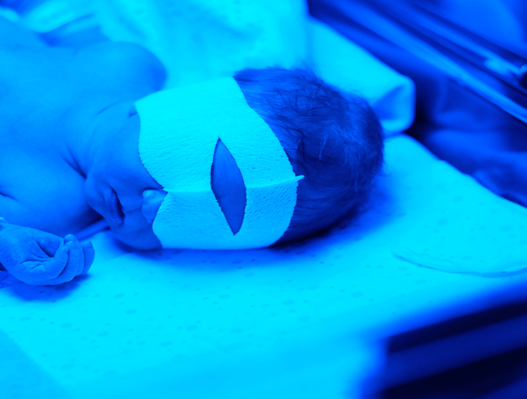 Verloskundigen Dronten - Geelzucht bij baby (Icterus)